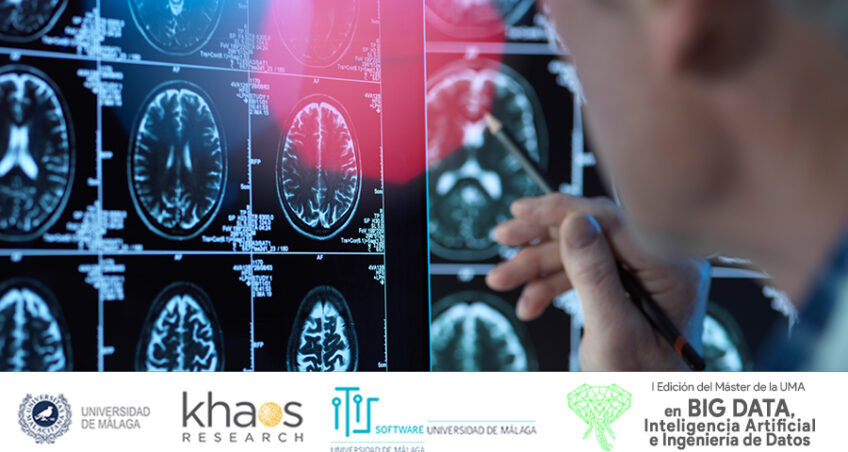 La inteligencia artificial abre nuevas puertas en la lucha contra el Alzheimer